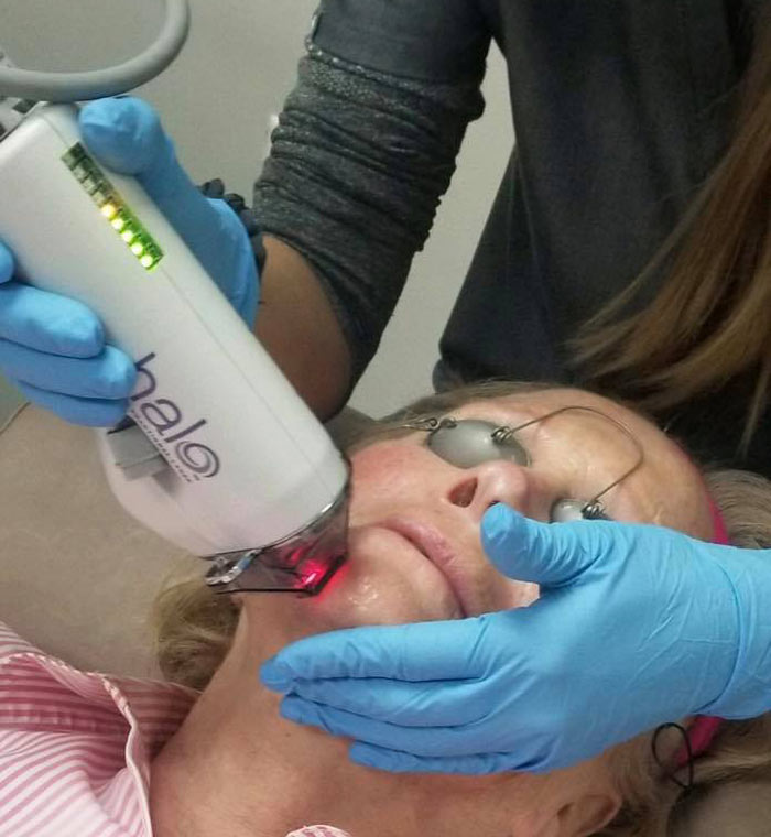 Laser-Hair-Removal