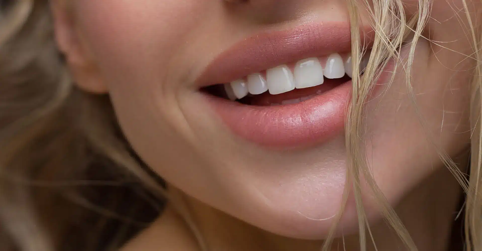 close up of a persons face focusing on their mouth and teeth they have light pink lips and are smiling showing white and straight teeth strands of blonde hair partially cover the right side of the face suggesting recent lip enhancement the background is blurred out