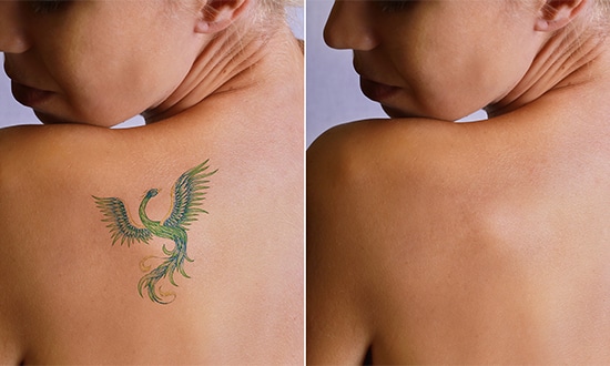 lynchburg aesthetics and wellness facetite
